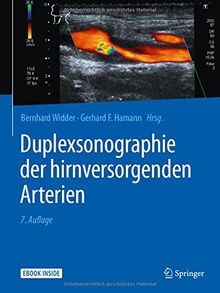 Duplexsonographie der hirnversorgenden Arterien