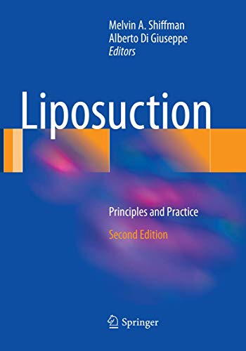Liposuction: Principles and Practice