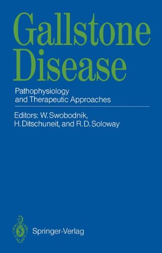 Gallstone Disease: Pathophysiology and Therapeutic Approaches