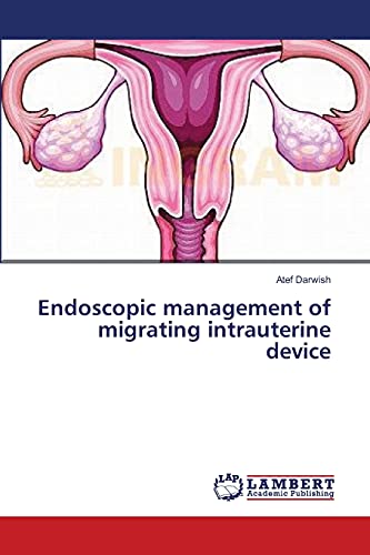 Endoscopic management of migrating intrauterine device
