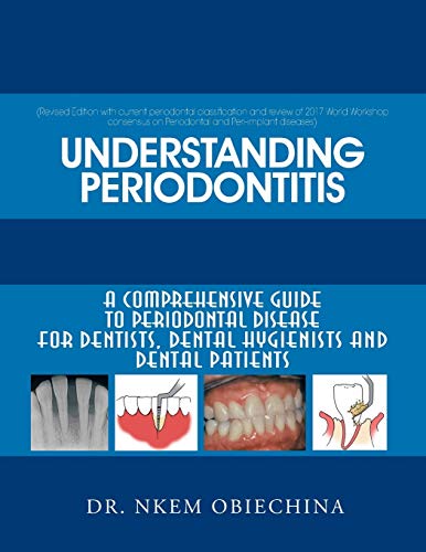 Understanding Periodontitis: A Comprehensive Guide to Periodontal Disease for Dentists, Dental Hygienists and Dental Patients